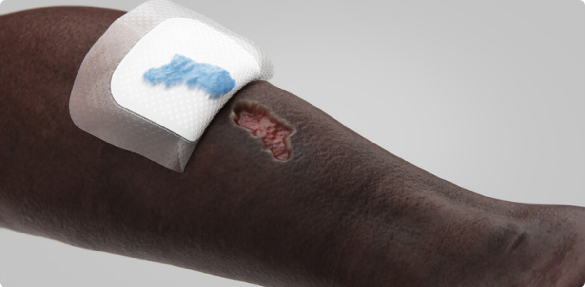Biatain® Silicone Fit